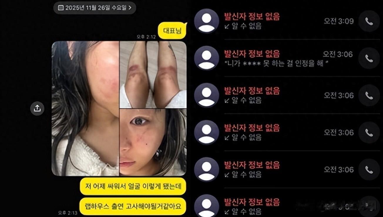 韩国女歌手自曝遭到男友殴打和监禁？