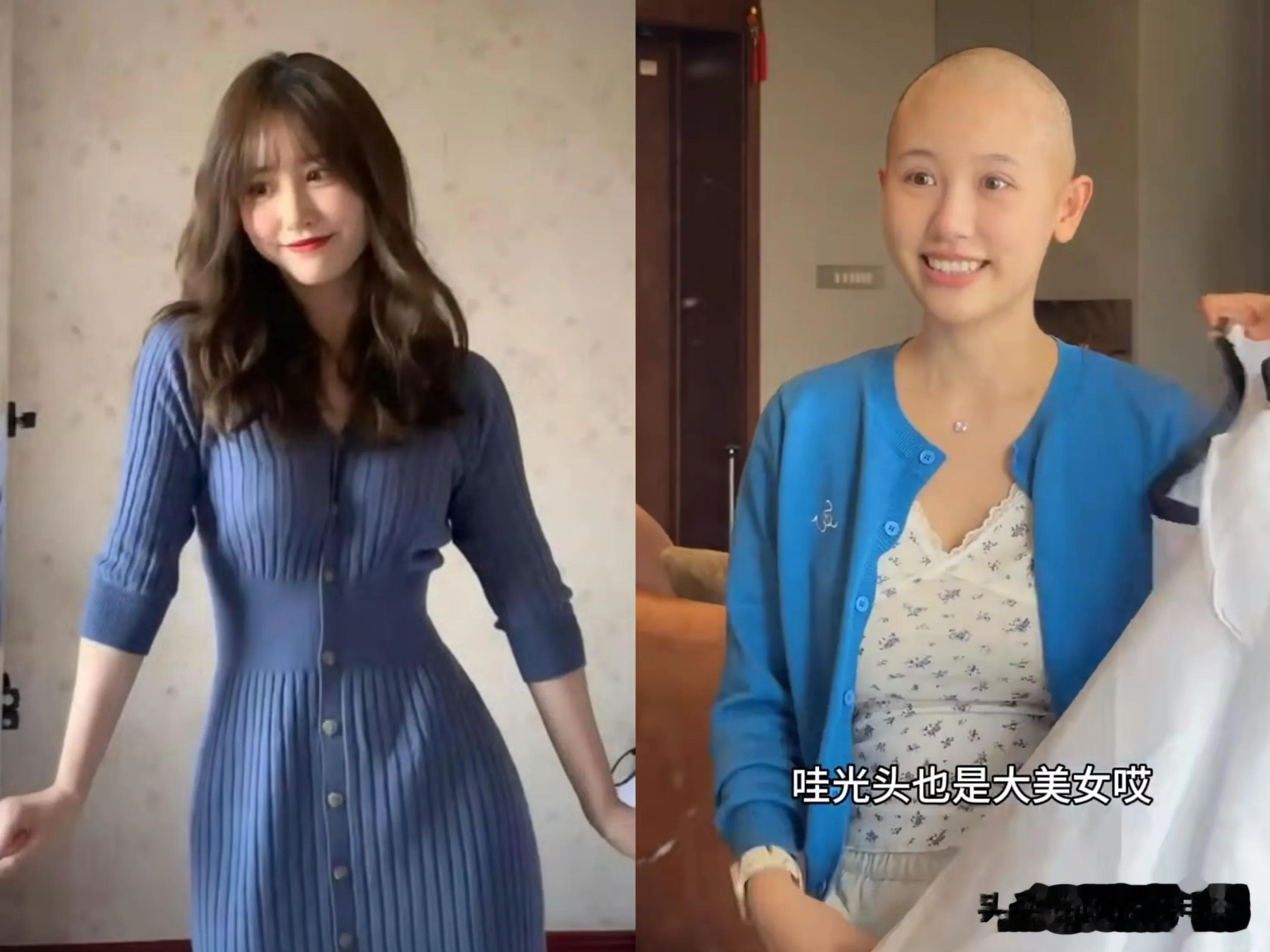 蓝衣战神当光头抗癌，一栗小莎子如今是炒作还是打怪升级？