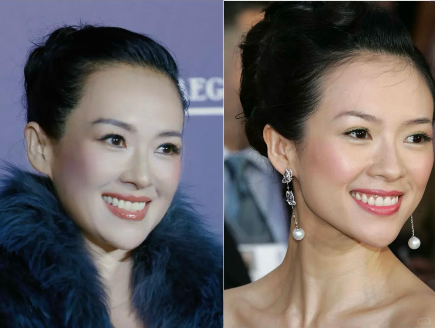 46岁章子怡香港被遇，医美过度脸大了一圈，网友惋惜失去骨相优势