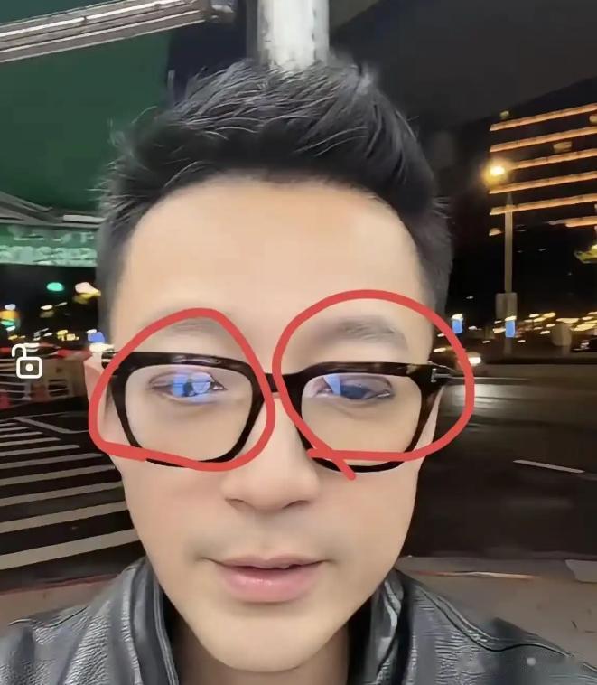 汪小菲忘开美颜满脸疤痕, S家和马筱梅难脱干系, 张兰位置意外曝光