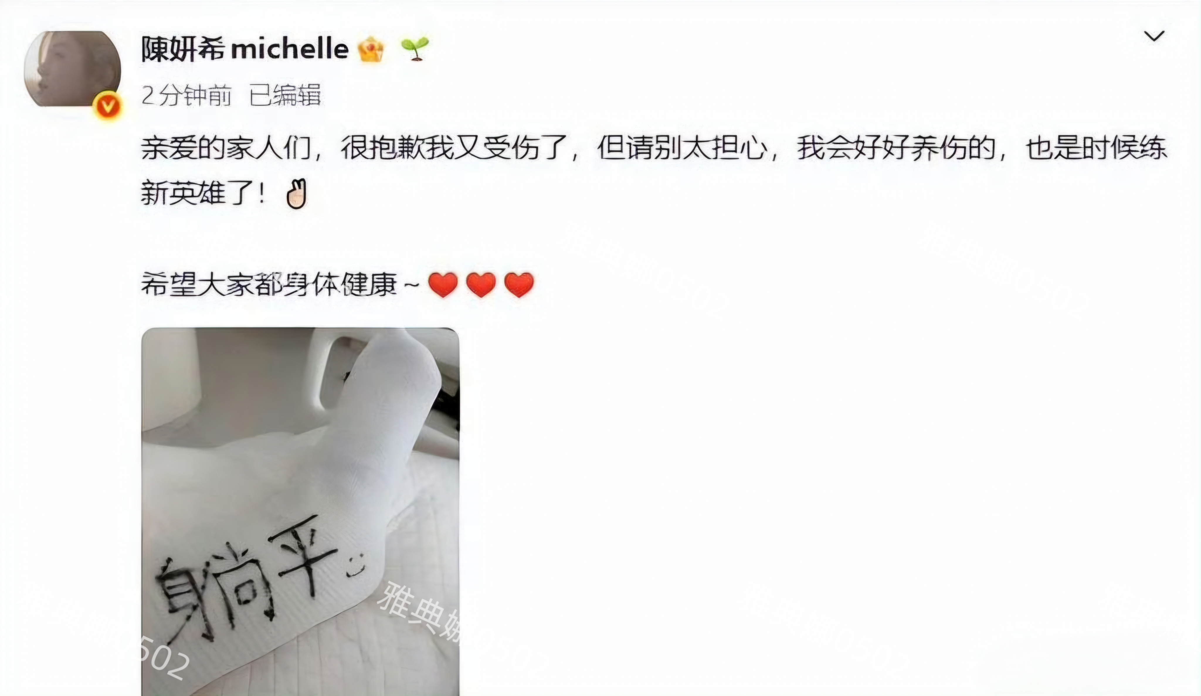 陈妍希的美貌被高估了素颜的她不是骨相美女,包子脸明显五官很钝