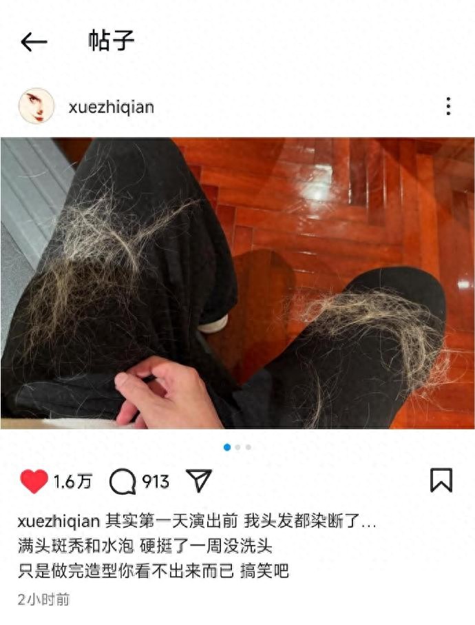 薛之谦满头斑秃和水泡，不值得同情，你也没资格心疼