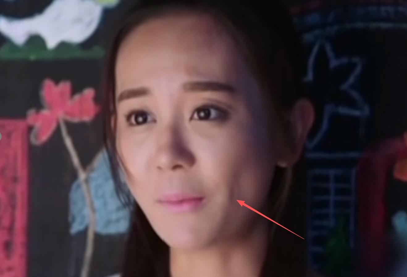 女演员千万别整容!央视《加油小茉》里39岁琼女郎,脸都快认不出