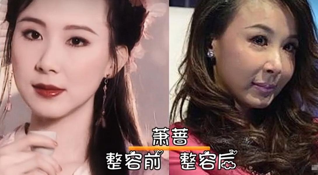 女演员千万别整容!央视《加油小茉》里39岁琼女郎,脸都快认不出