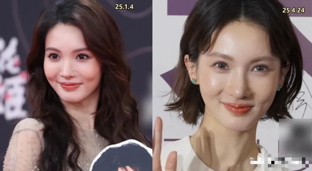 突发!金晨承认肇事逃逸,晒满脸是血照片,知情人曝她刚做了鼻子