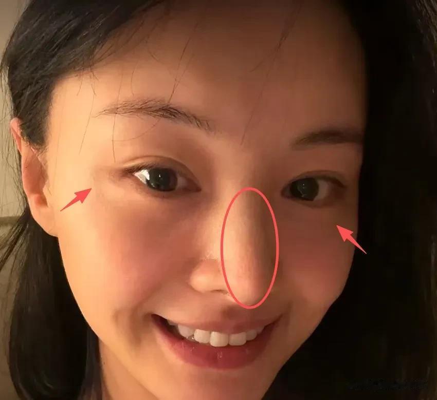 郑爽分享美国近况,穿搭不输当红明星,自曝做医美网友直呼认不出