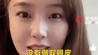 张佳宁冲上热搜，坦诚回应双眼皮争议