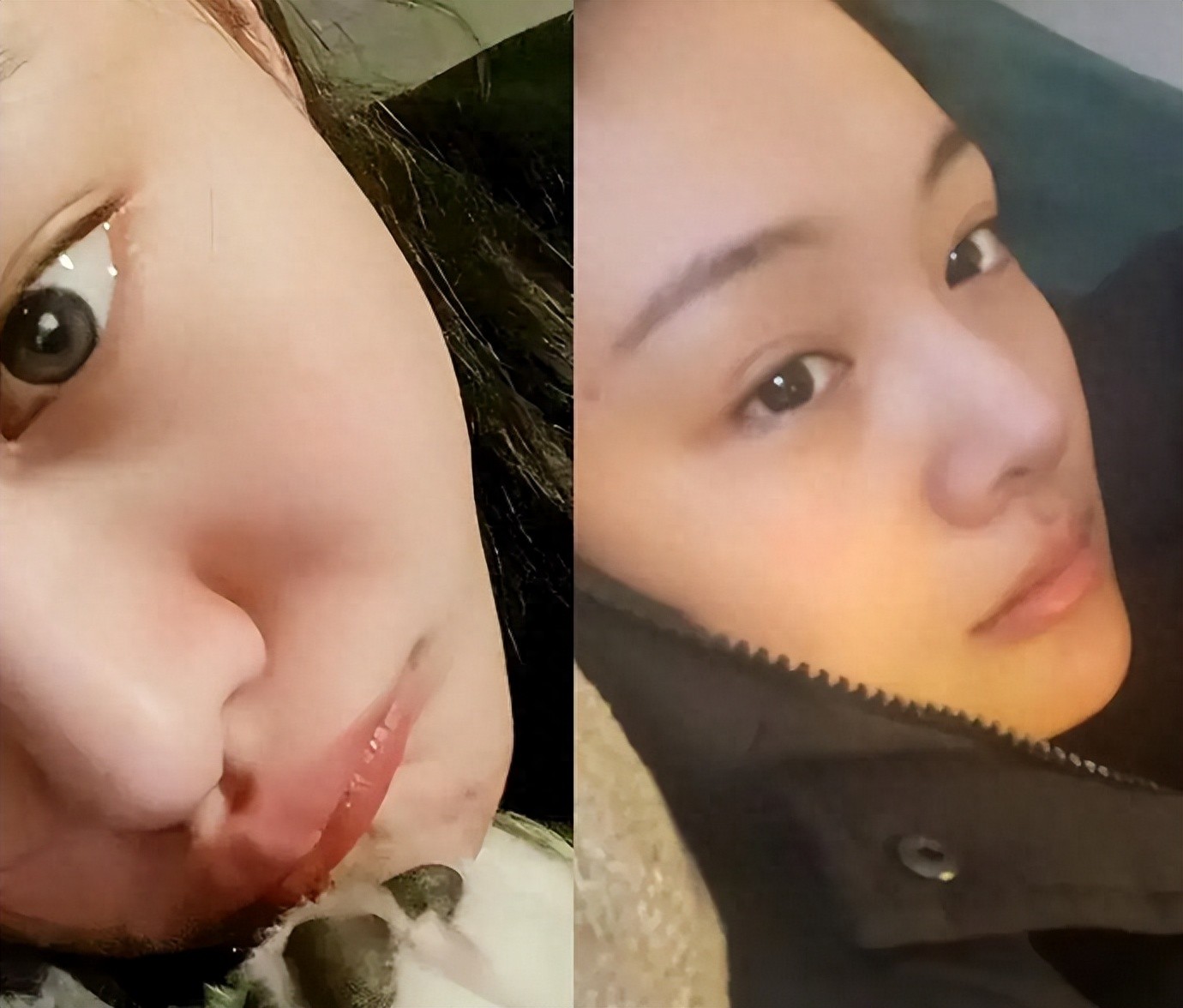 35岁郑爽整容后遗症明显,身后豪宅暴露真实财力,却走不了回头路