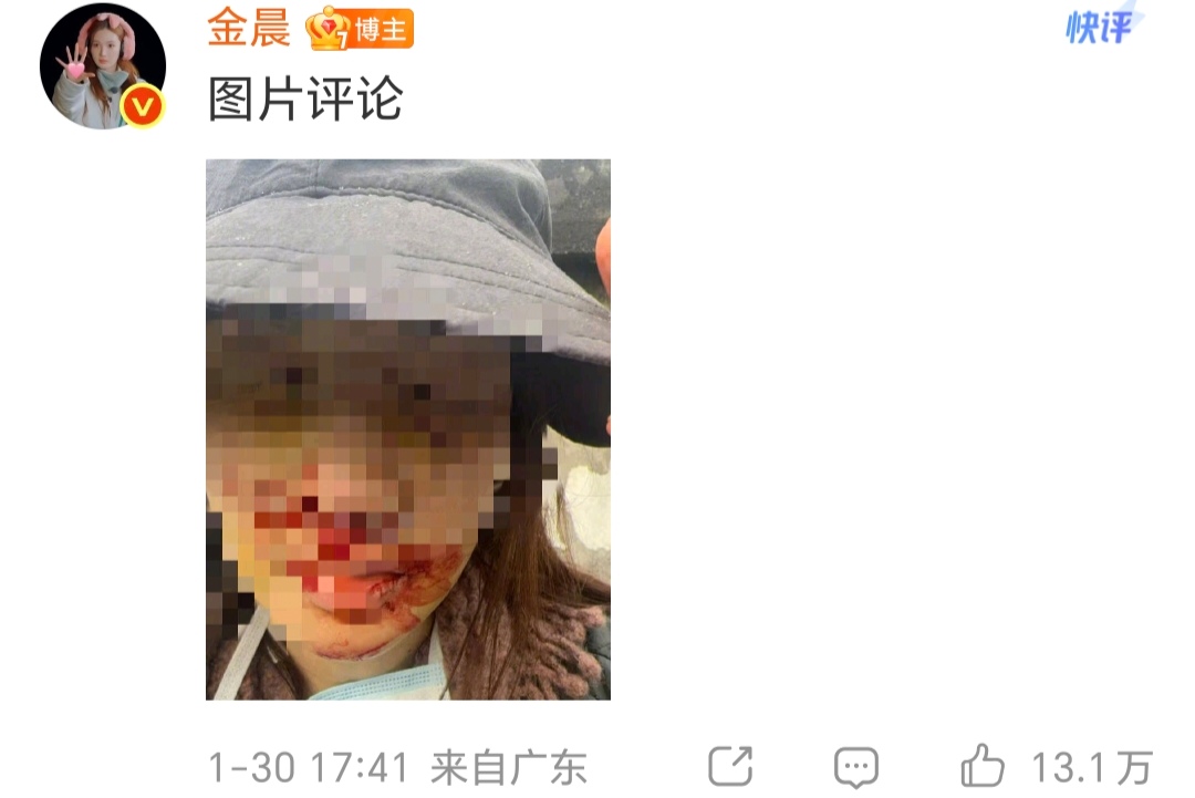 金晨新西兰被偶遇，大方和网友合影脸超小，一头小卷发好漂亮