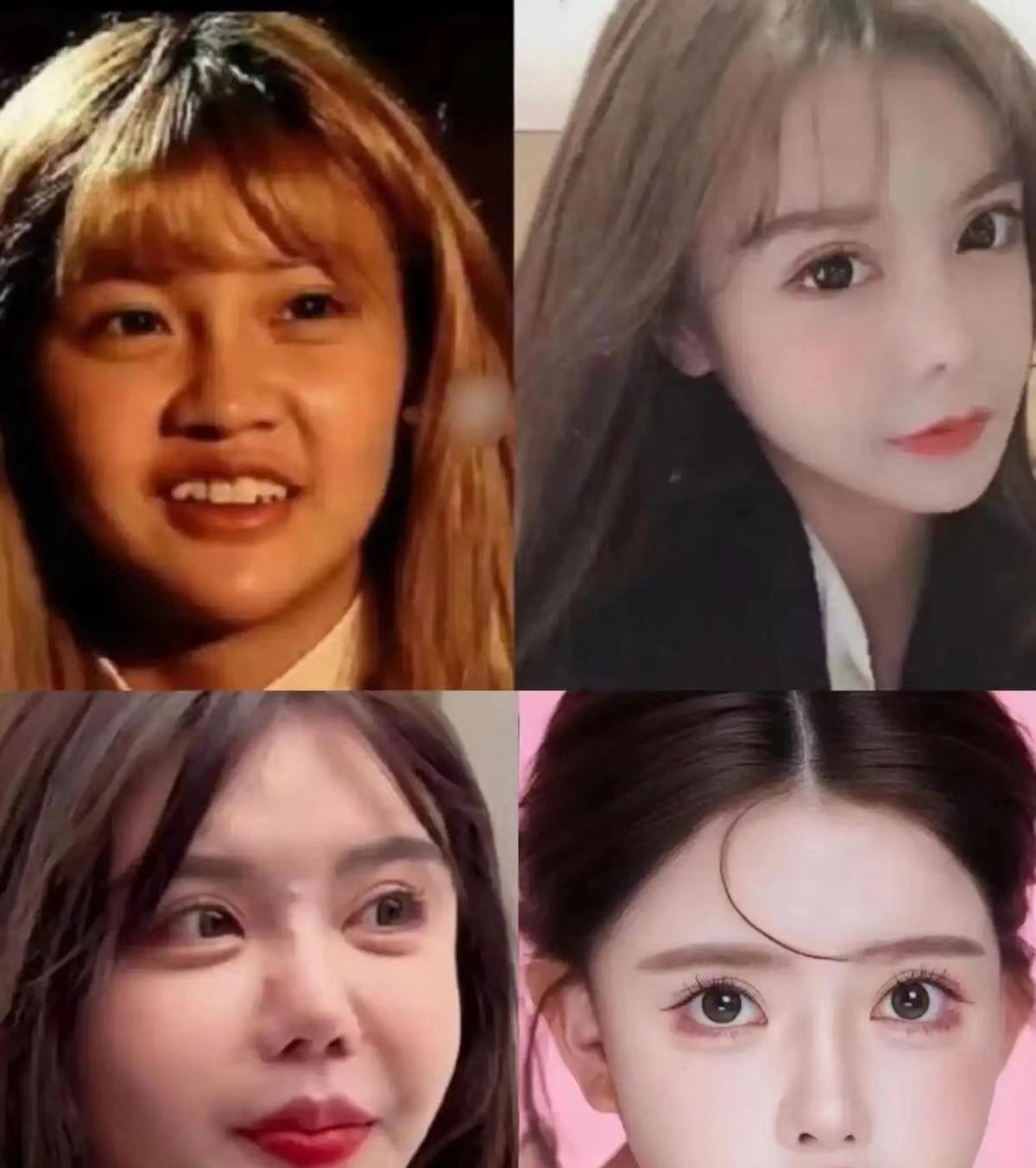 四次婚变、未婚先孕、撕裂母亲,整容33次,她26岁为何如此疯狂?