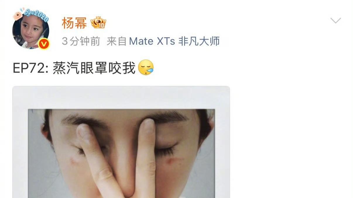 杨幂脸被蒸汽眼罩“咬”了？这波“低温烫伤”科普我给满分！