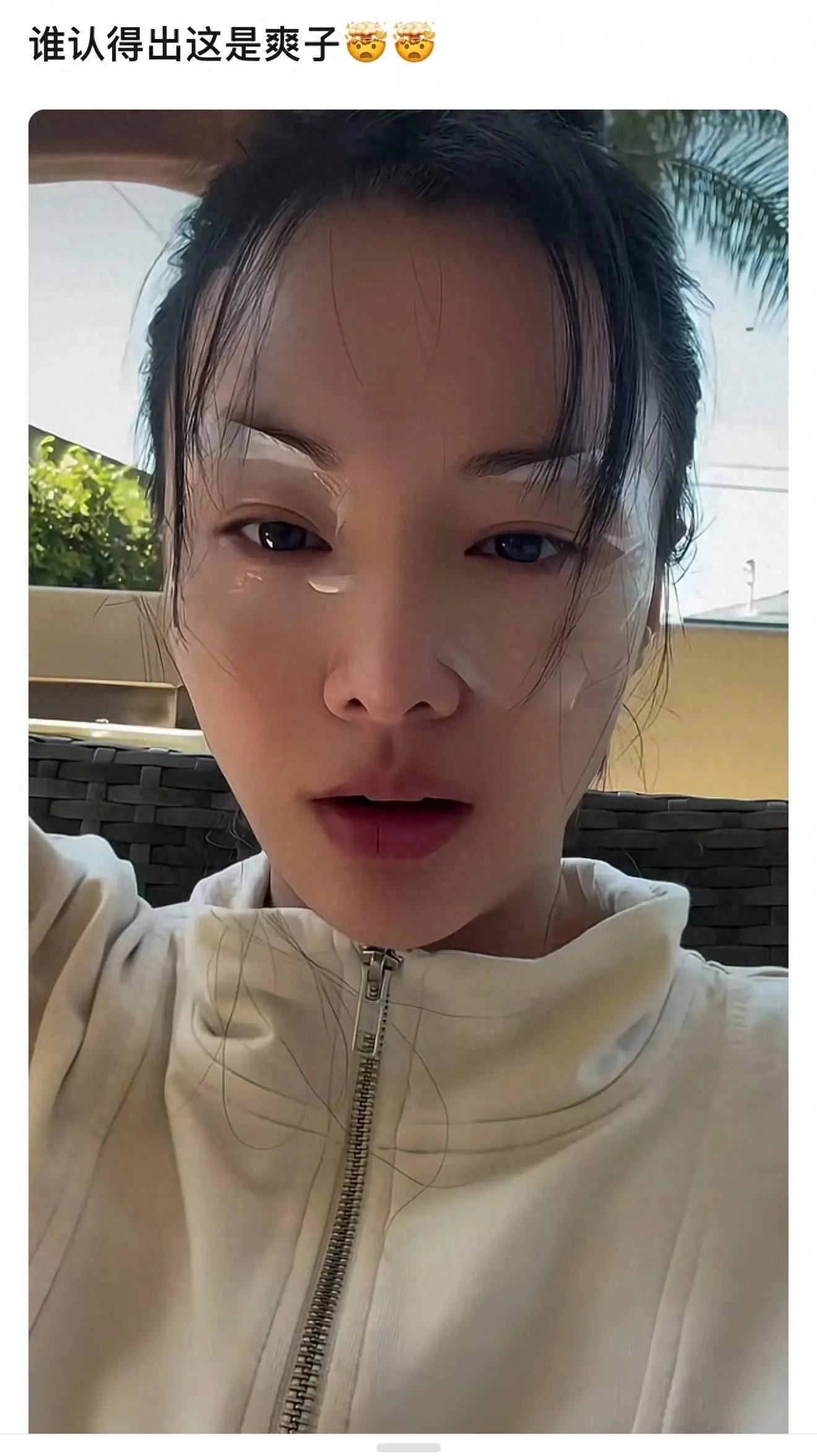 封杀五年后，34岁郑爽在美直播与粉丝重聚，面部僵硬发际线稀疏