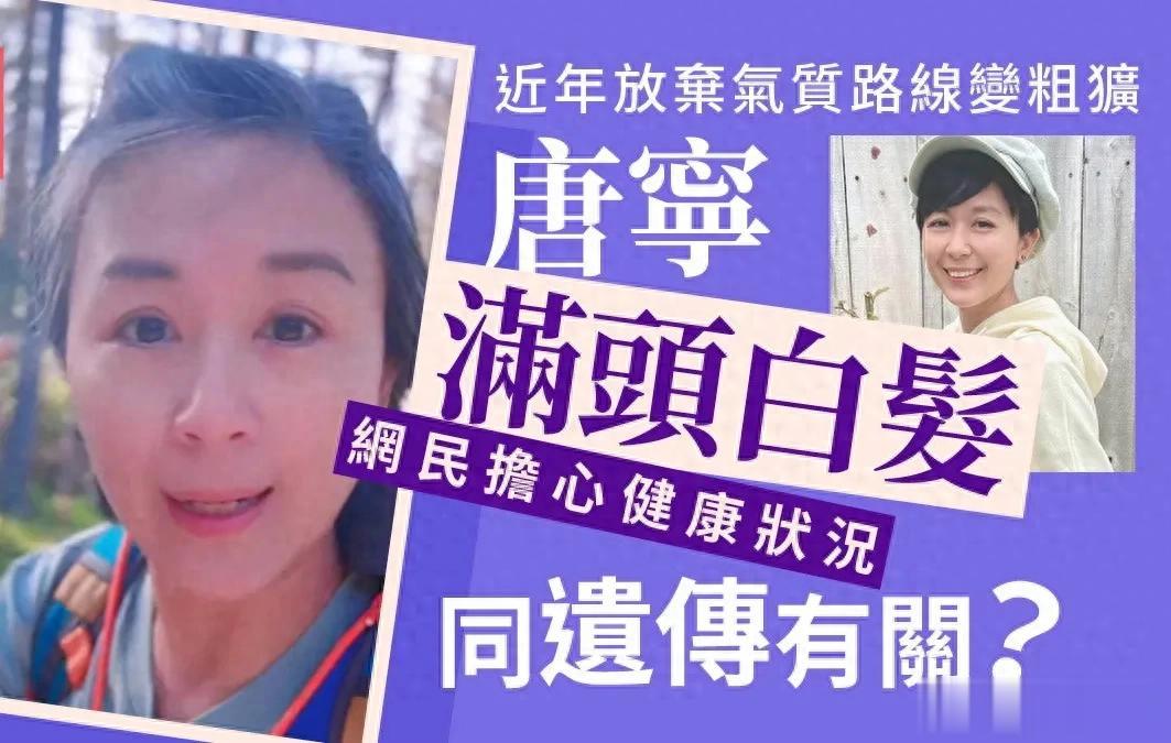 44岁满头白发被质疑健康出问题 唐宁亲自回应 这不是衰老是 主动选择