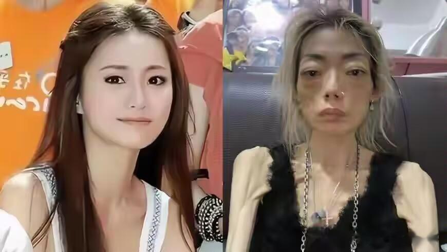 一代女神沦为豪门玩物：结婚8年后牙齿全掉、器官切除、面似骷髅