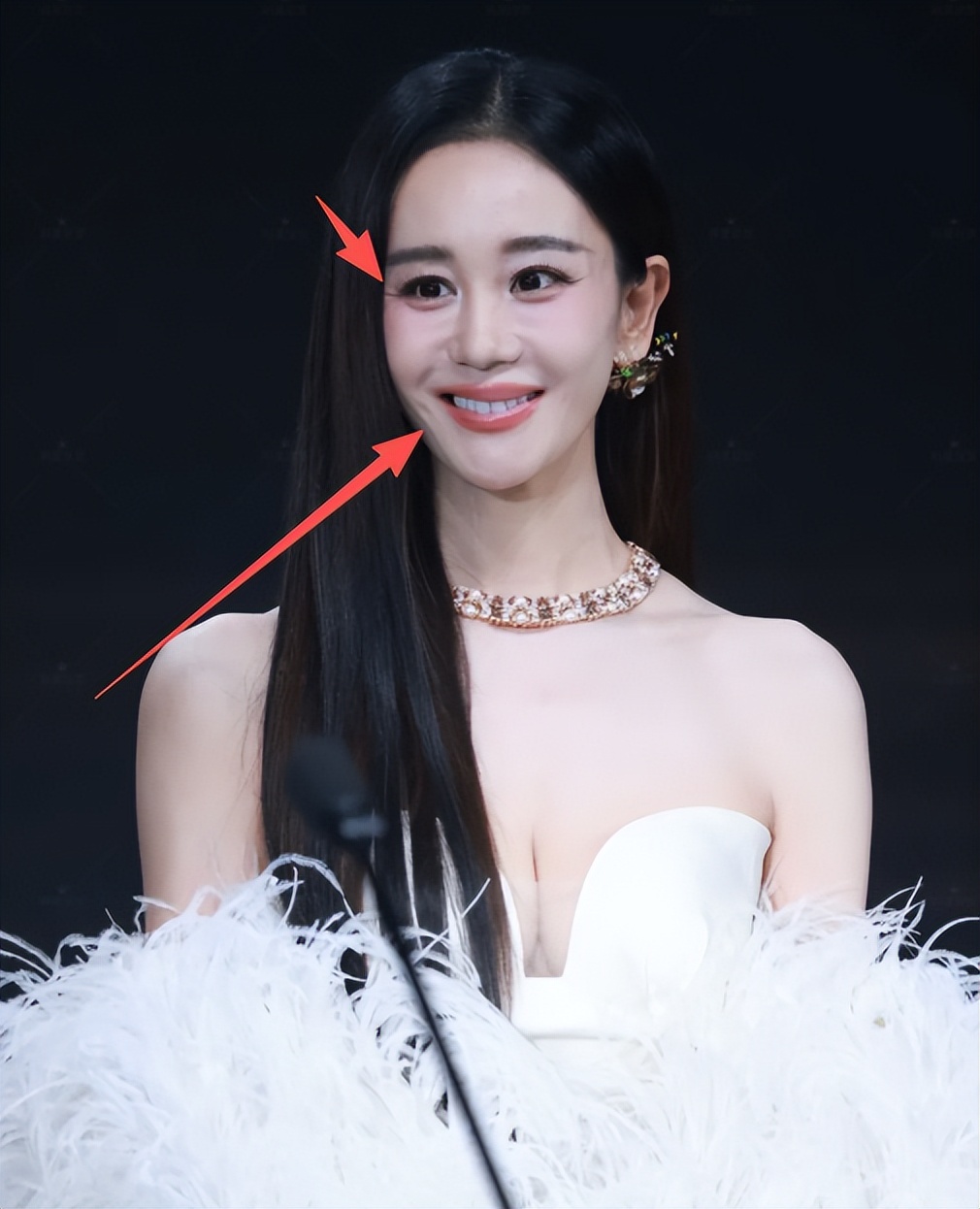 女演员千万别整容!央视《加油小茉》里39岁琼女郎,脸都快认不出