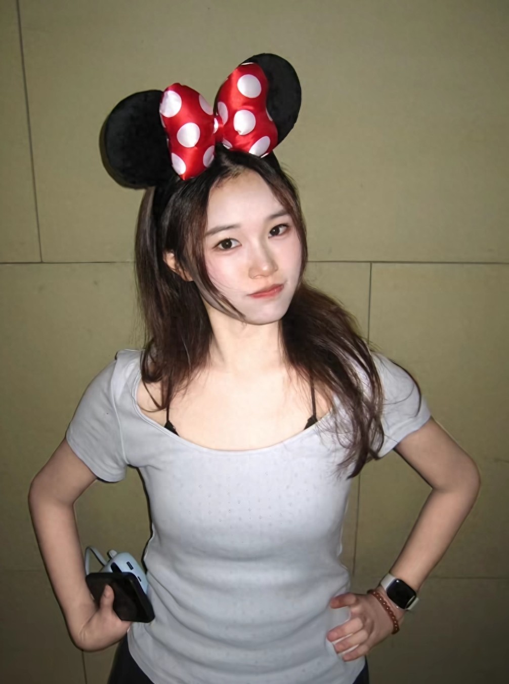 湖南美女“克拉姐姐”去世，仅25岁，长得很漂亮，死因和胎痣有关