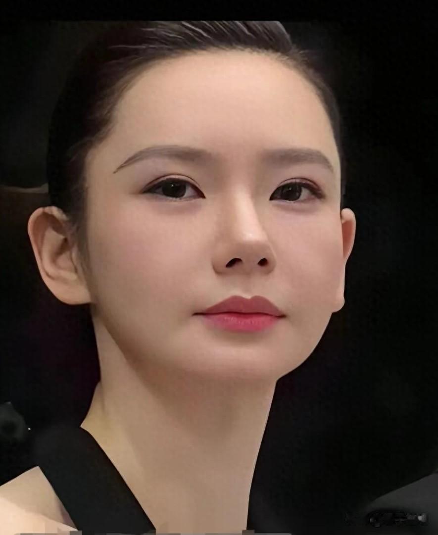 戚薇五官漂亮，她精致的脸盘眼睛是割了双眼皮的，鼻子是垫出来的