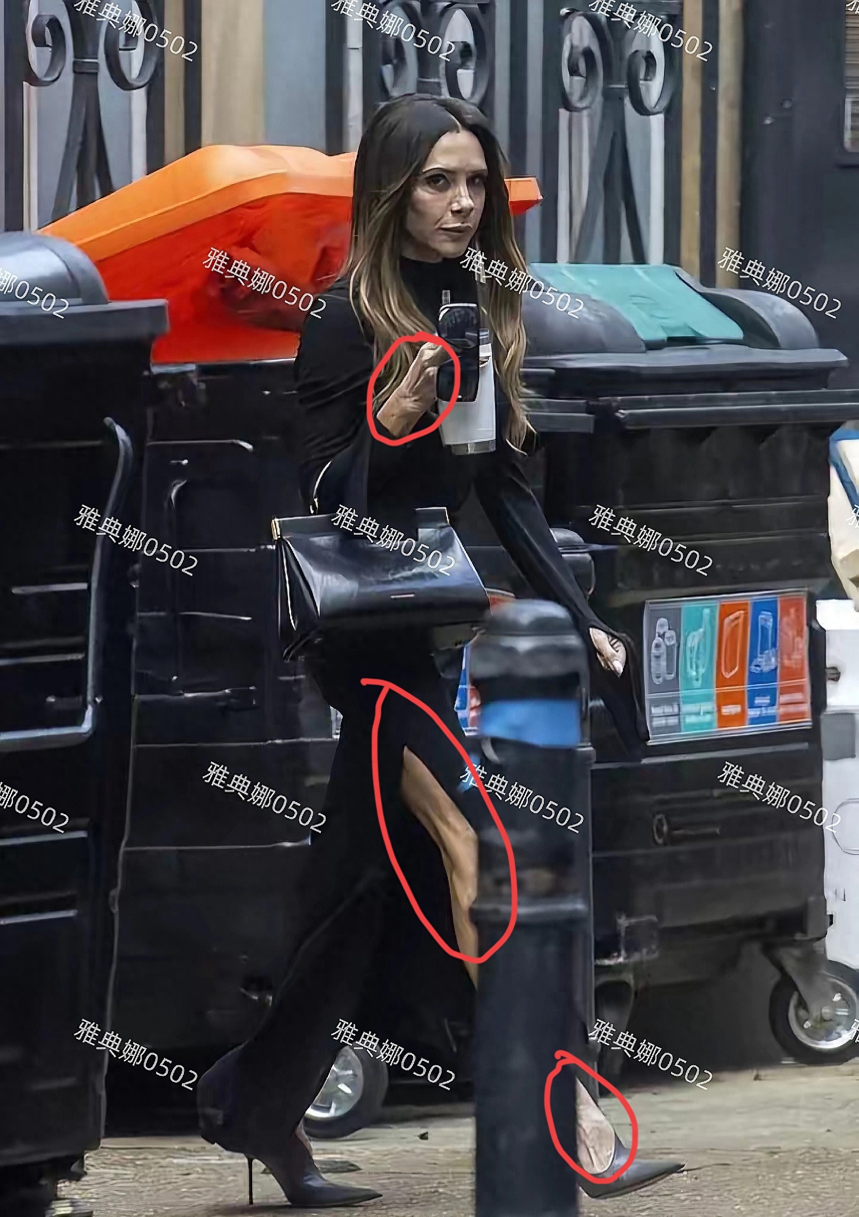 贝克汉姆老婆维多利亚太瘦了,不仅手青筋凸起腿更是只剩一把骨头