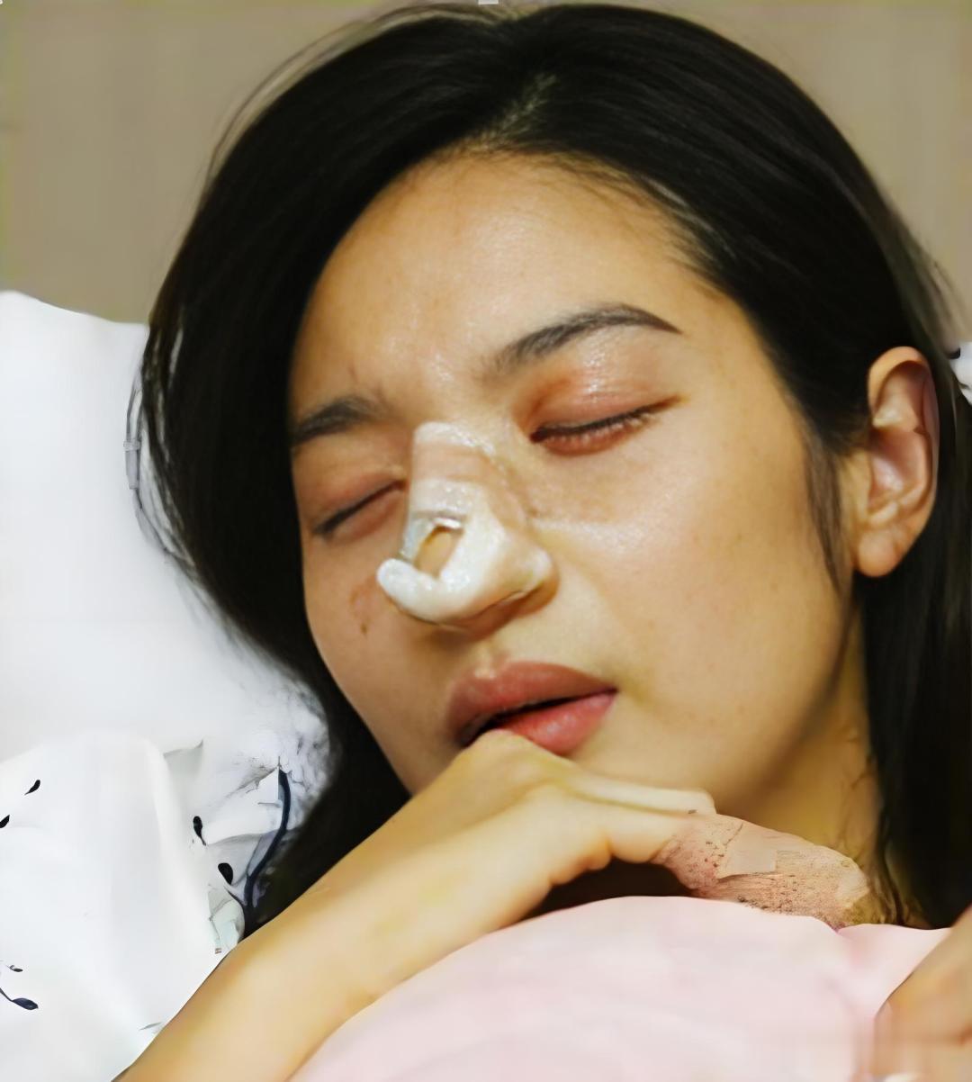 李敏英：新婚13天被丈夫砍断手指，虐待到终生不孕，如今怎样了？