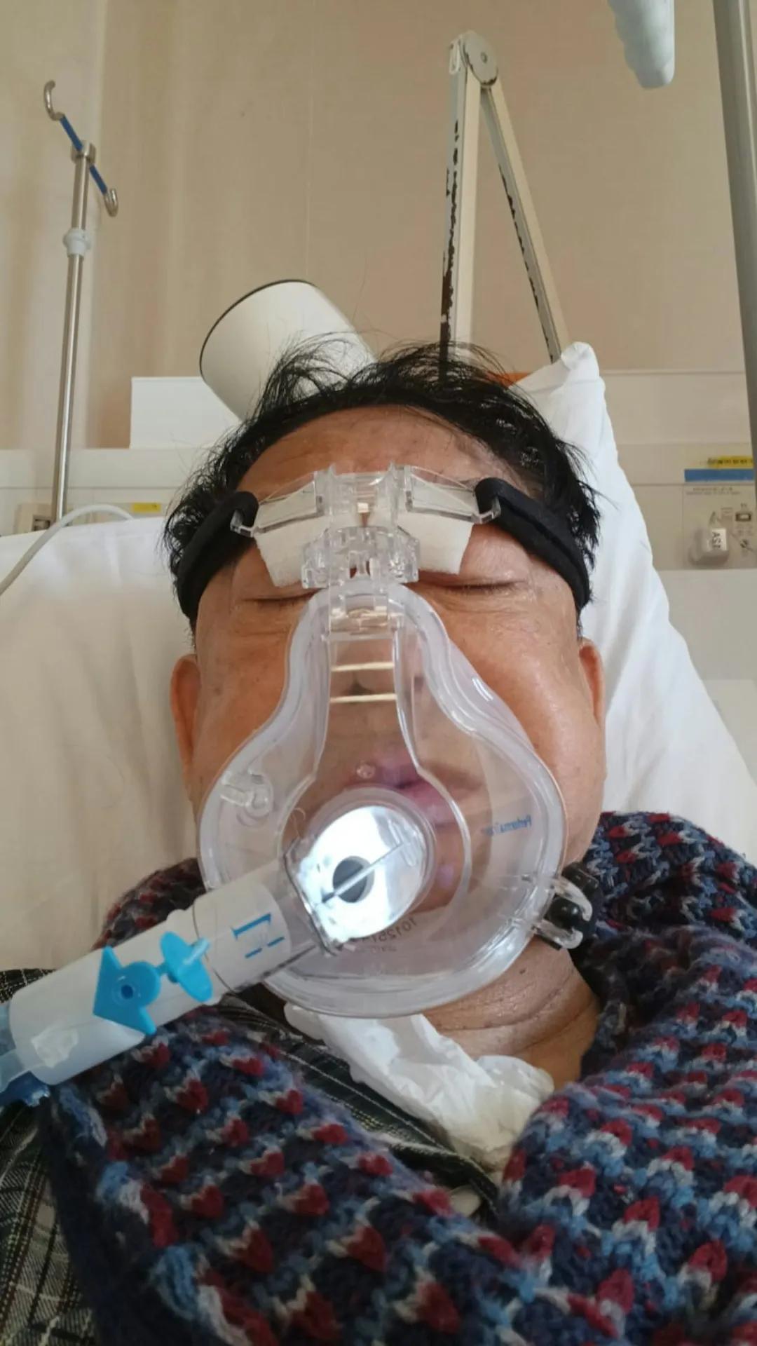 76岁TVB老戏骨近况曝光瘦到脱相,多次进出ICU,自爆肺肾功能出问题