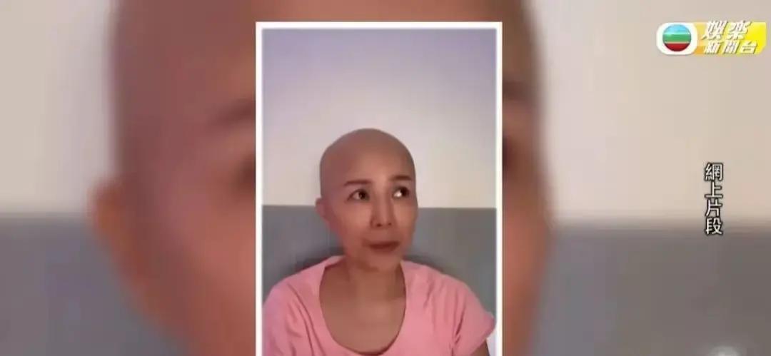 51岁港姐自曝癌症已到晚期，胸部溃烂流脓发臭，已提前筹备追思会