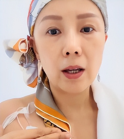 51岁港姐癌症晚期自曝已办追思会，称身体流脓发臭，标靶药已无效