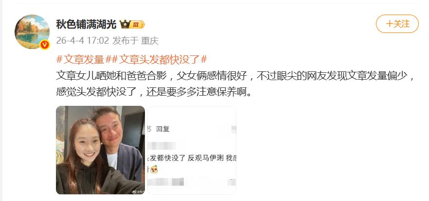 演员文章女儿晒和爸爸合影，网友发现文章发量少，感觉头发快没了