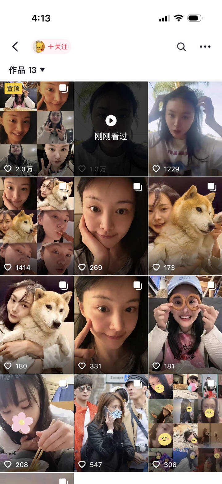 封杀五年后，34岁郑爽在美直播与粉丝重聚，面部僵硬发际线稀疏