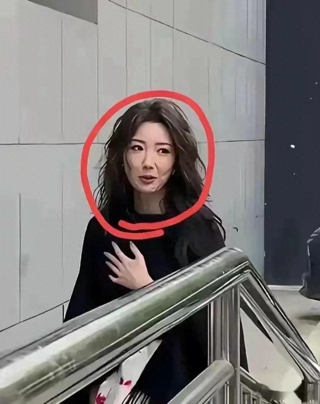 37岁毛晓彤医美后遗症，前脸肿胀，浓妆都遮不住！