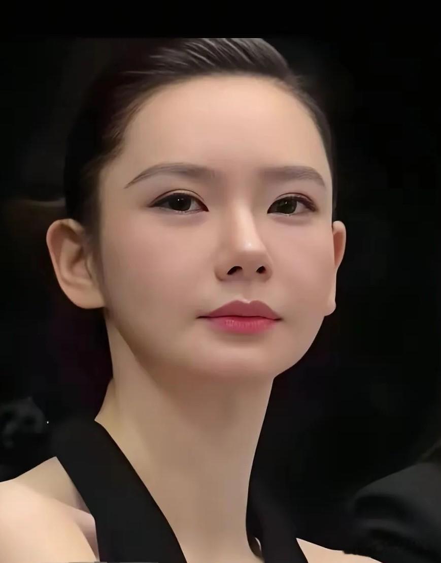 戚薇五官漂亮，她精致的脸盘眼睛是割了双眼皮的，鼻子是垫出来的