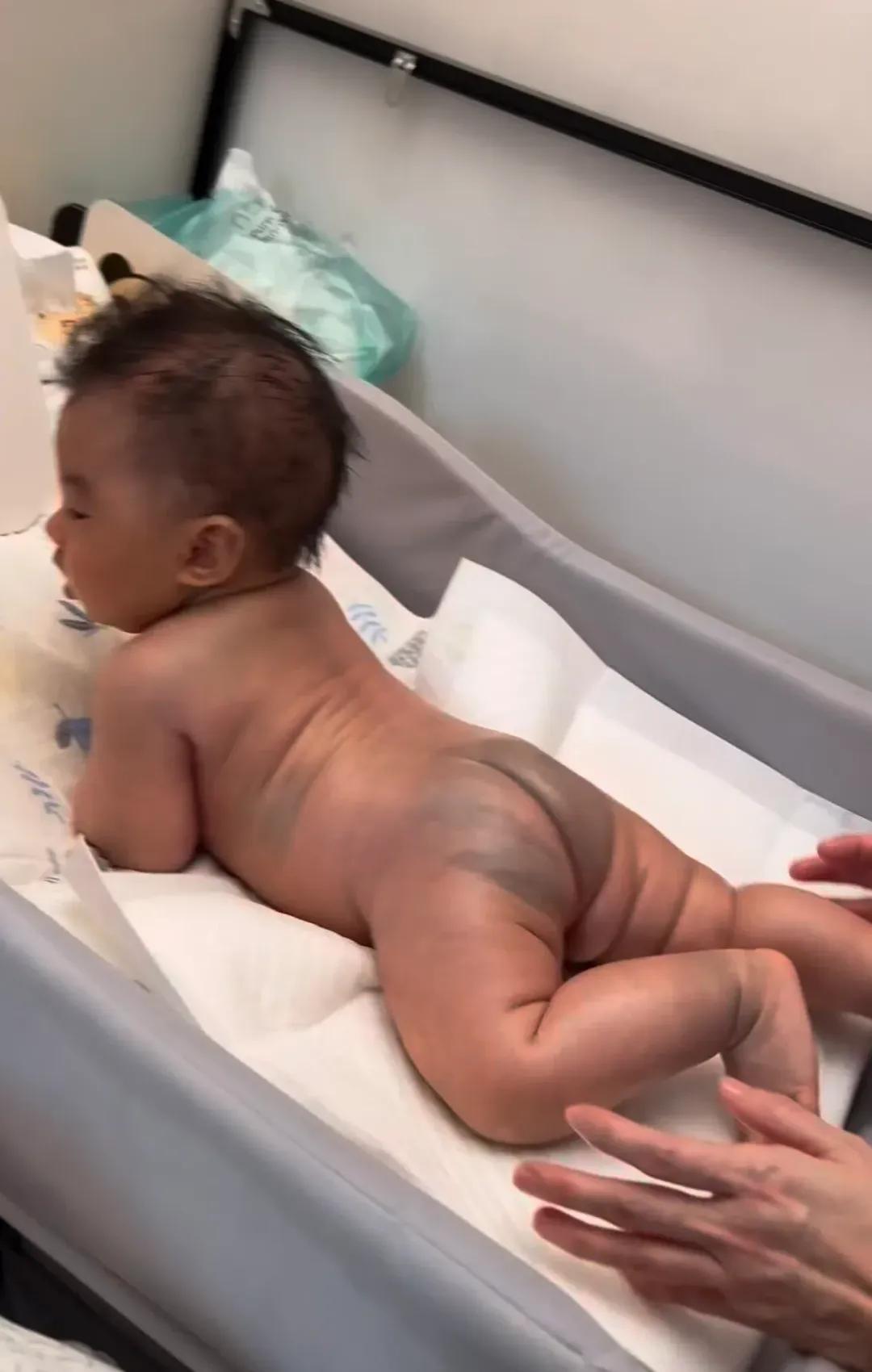 TVB男星袁伟豪小儿子全身成出现瘀黑色斑，网友感惊讶及担心