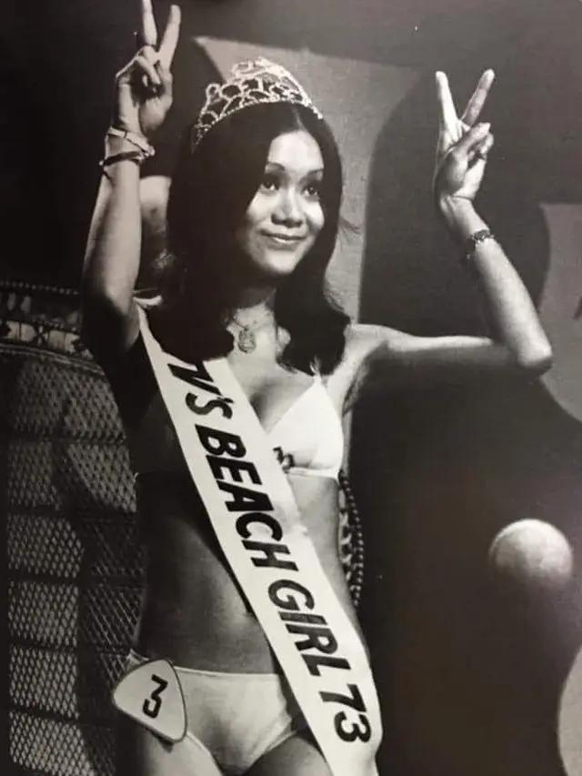 71岁前女星街头意外摔倒受伤流血,叹年纪大身体变弱,网友留言关心