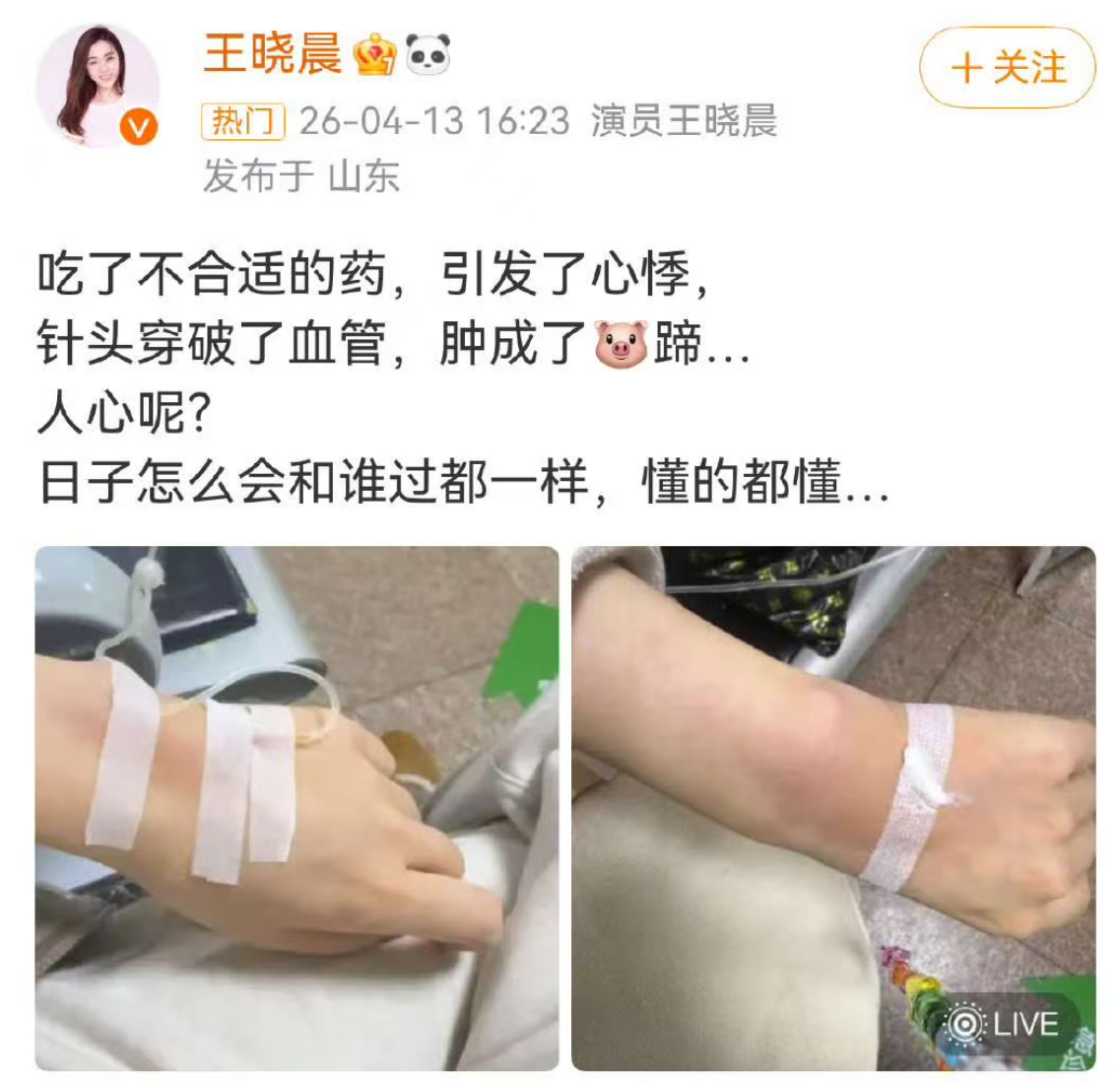 王晓晨病中感慨“懂的都懂”，牵动俞灏明恋情猜测