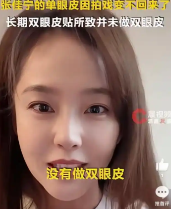 张佳宁冲上热搜，坦诚回应双眼皮争议